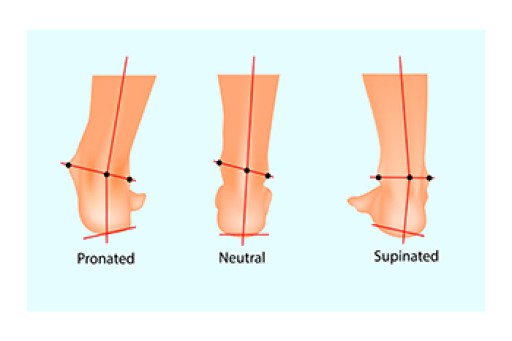 The Importance of Biomechanics in Podiatry