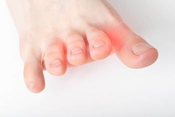 Foot Pain