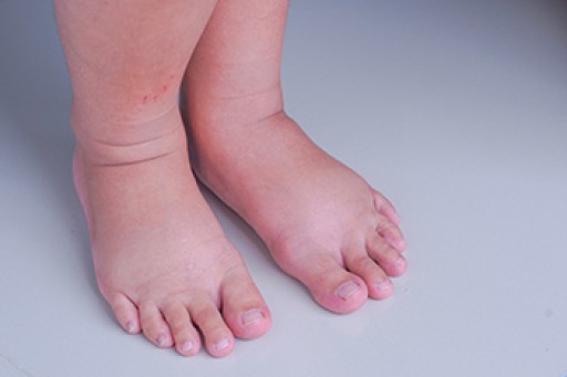 Pregnancy and Foot Health