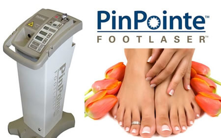 Laser Treatment for Fungal Nail - Waverley Foot Clinic